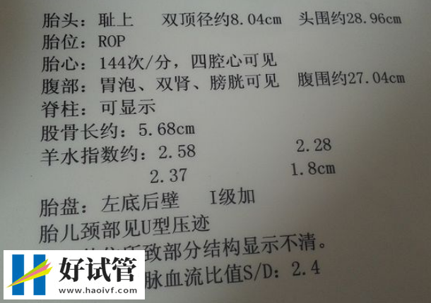1-40孕周羊水指数对照表mm,数值异常会影响胎儿发育(图2) 羊水过多会导致胎儿呼吸困难